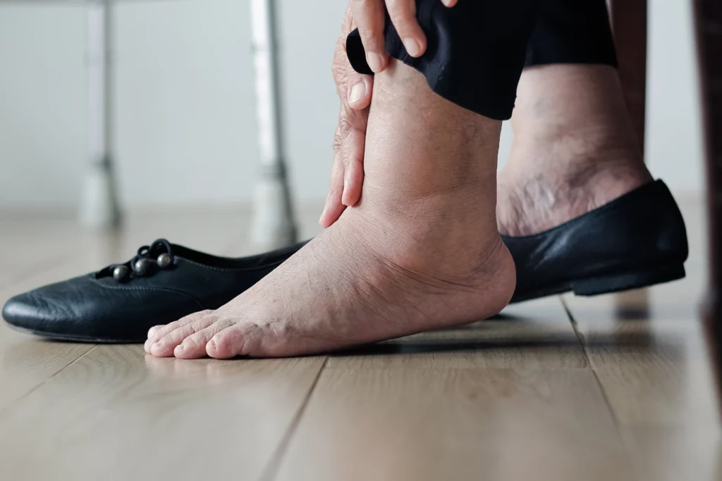 اسباب انتفاخ القدمين